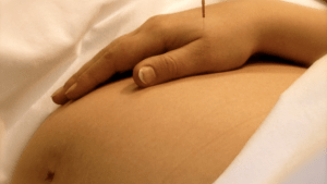 Acupuncture Pregnant Belly